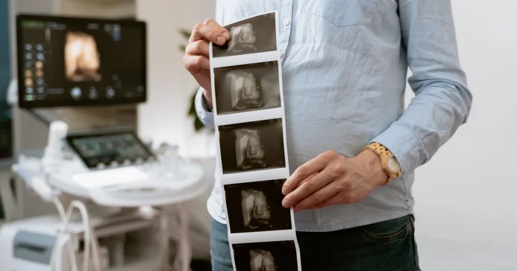 Peran Bidan dalam Pemantauan Masa Nifas untuk Kesehatan Ibu dan Bayi