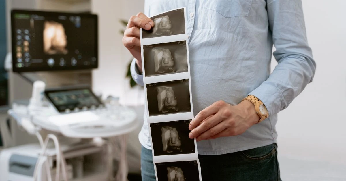 Peran Bidan dalam Pemantauan Masa Nifas untuk Kesehatan Ibu dan Bayi